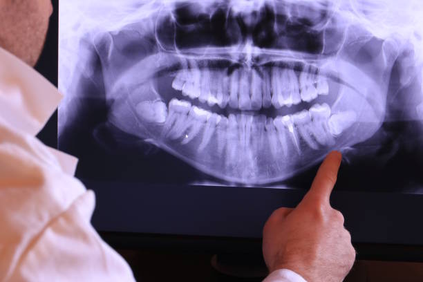Best Urgent Care for Lost Fillings or Crowns in Madisonville, KY