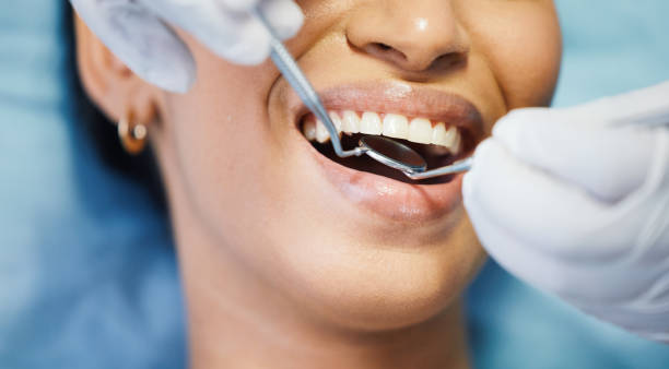 Best Emergency Gum Treatment in Madisonville, KY